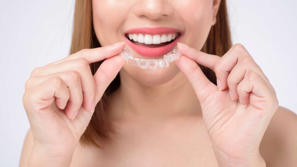 Why West Hollywood Residents Prefer Invisalign Over Braces in 2025