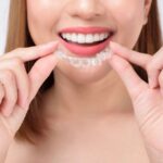 Why West Hollywood Residents Prefer Invisalign Over Braces in 2025