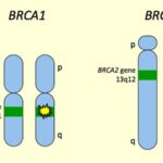 BRCA1 and BRCA2 Genes