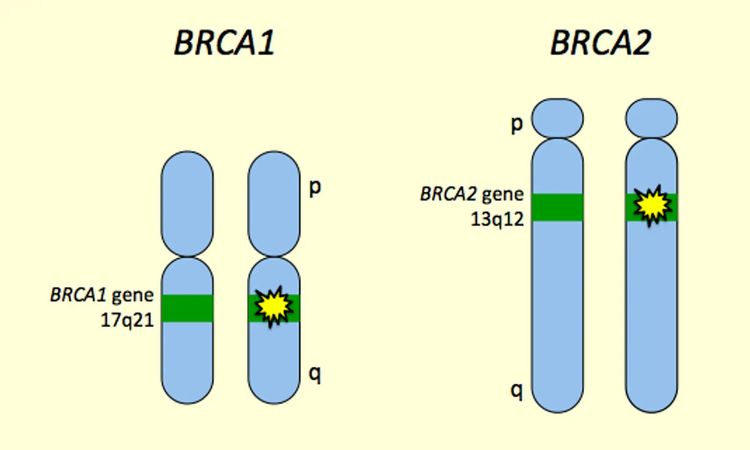 BRCA1 and BRCA2 Genes