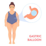Non-Surgical Shortcut to Weight Loss