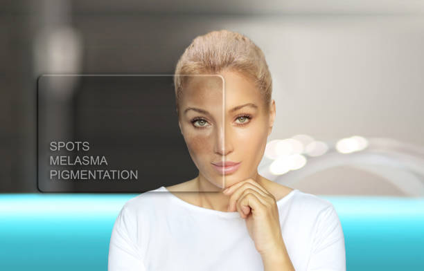 CO2 Laser Treatment Unveiled