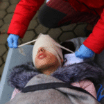 Neck and Back Injury Claims After Personal Injury Accidents