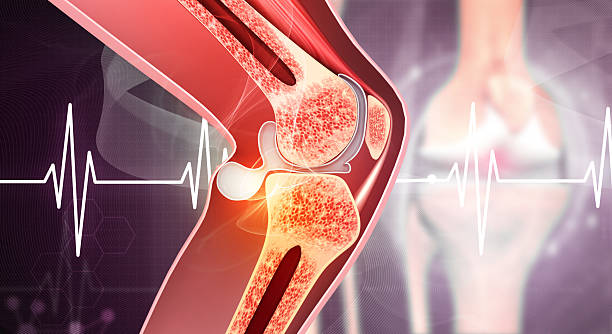 Strengthening Joints